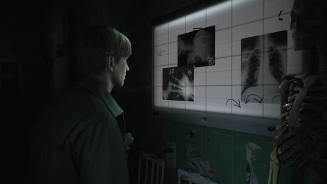 《Silent Hill 2 Remake》只有12项Steam成就